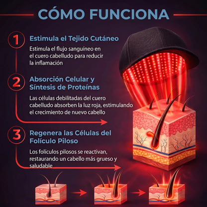 lumavita™ hair growth laser cap